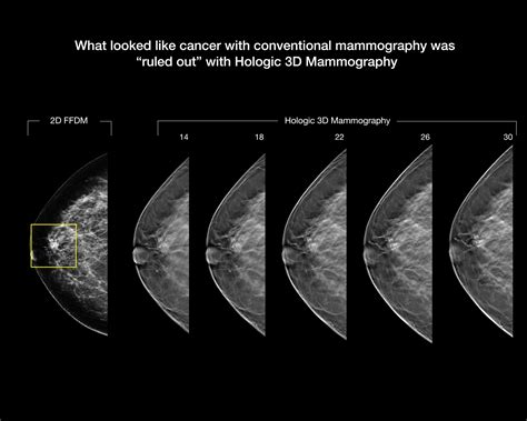 Diagnose Zentrum Brigittenau » Mammographie