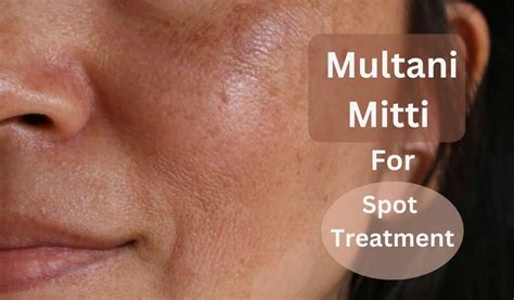 Multani Mitti Benefits For Skin Care: How To Use For Face Glow