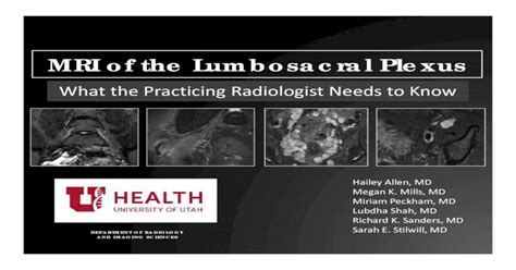 MRI of the Lumbosacral Plexus - - MRI of the Lumbosacral Plexus... · Be familiar with normal ...