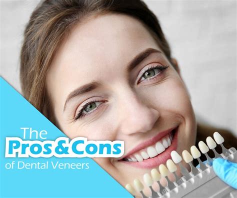 Pros and Cons of Dental Veneers