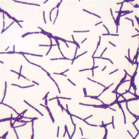 Typical Bacillus Bacteria Microscope slides | Carolina.com