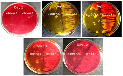 Isolation of Acetic Acid Bacteria and Preparation of Starter Culture for Apple Cider Vinegar ...