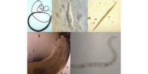 What are Helminths? – Microscope Clarity