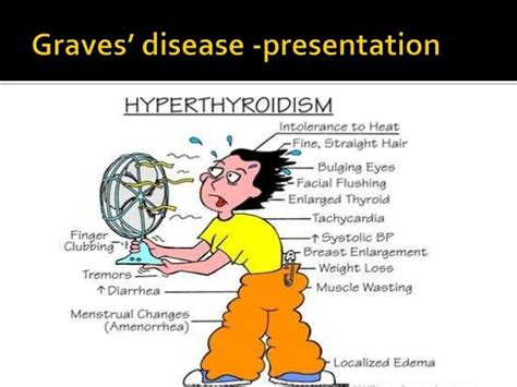 Grave’s disease