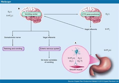 Metoclopramide in the Treatment of Diabetic Gastroparesis