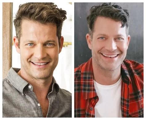 Nate Berkus Plastic Surgery and Teeth Transformation