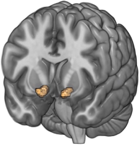 The left ventral striatum (IVS, MNI coordinates [x y z] = -13, 8, -13;... | Download Scientific ...