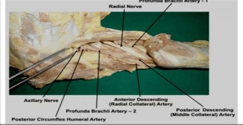 Showing photographic presentation of the profunda brachii artery -1 ...