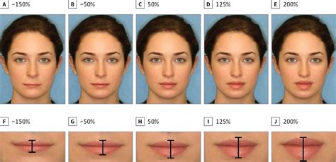 A Quantitative Approach to Determining the Ideal Female Lip Aesthetic and Its Effect on Facial ...