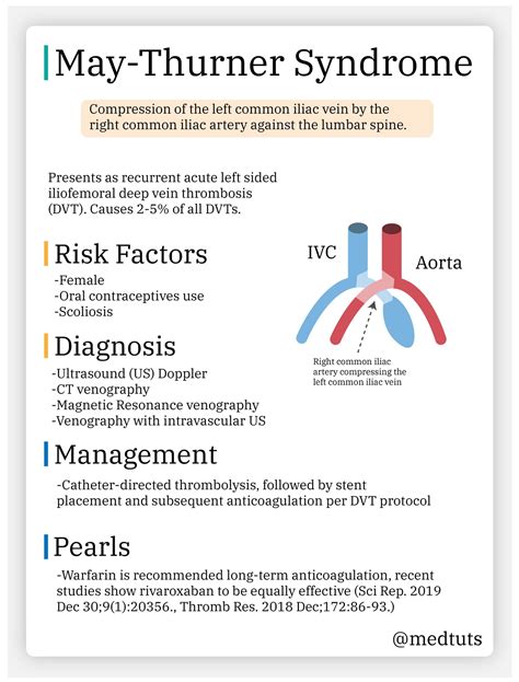 May-Thurner Syndrome