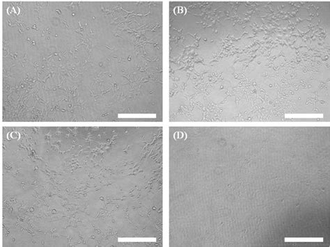 Microscopy images of HEK 293 cells: (A) cells without any treatment ...