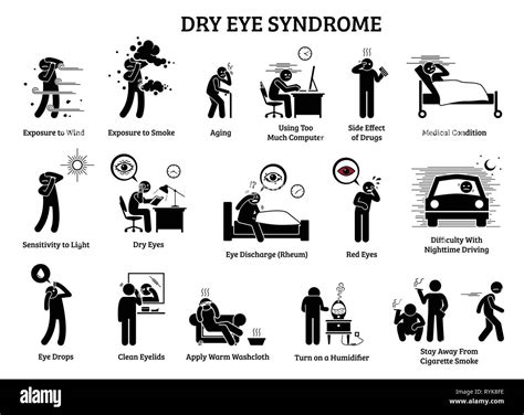 Dry Eye Syndrome. Icons illustrations depict the symptoms, causes, effects, and home remedies ...