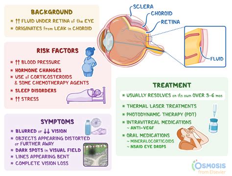 Central Serous Retinopathy: What It Is, Causes, Signs and Symptoms, and More | Osmosis