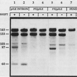 Identification of a novel pre-tRNA splicing intermediate. Total RNA was... | Download Scientific ...