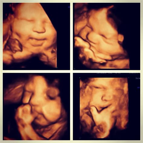 30 weeks pregnant 4d ultrasound - nibhtwc