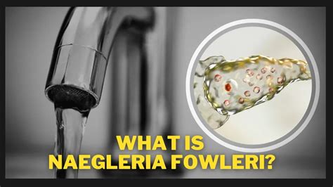 What Is Naegleria Fowleri? The Deadly Brain-Eating Amoeba Infection Reported In Korea: Symptoms ...