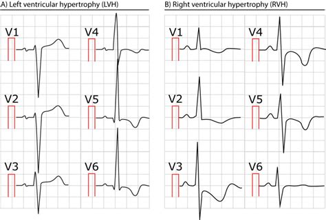 Chapters Archive – Page 11 of 16 – ECG & ECHO