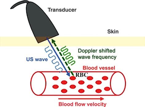 Doppler principle. The Doppler shift (Δf) can be calculated as ...