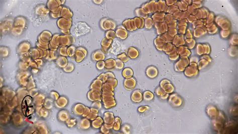 White Blood Cells Under Microscope Labeled