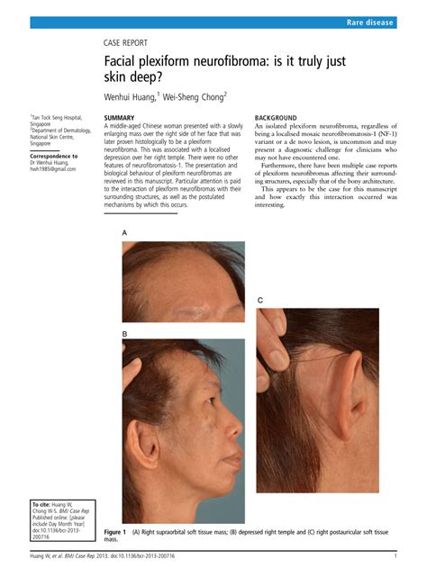 (PDF) Facial plexiform neurofibroma: Is it truly just skin deep?