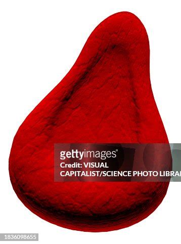 Teardrop Cell Abnormal Red Blood Cell Illustration High-Res Vector Graphic - Getty Images