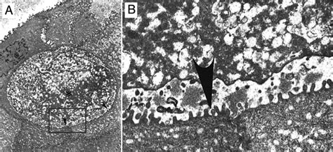 Presence of a "peculiar" electron-dense substance in the... | Download Scientific Diagram