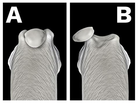 The cause and consequences of patellar luxation in dogs - Veterinary Practice