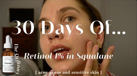 I Used The Ordinary 1% Retinol in Squalane For 30 Days | Acne Scarring Before and After - YouTube