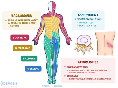 Thoracic Dermatomes Shingles - Dermatomes Chart and Map