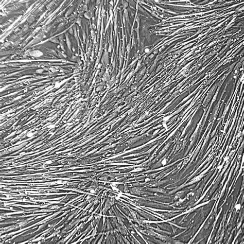 Human Skeletal Muscle Satellite Cells