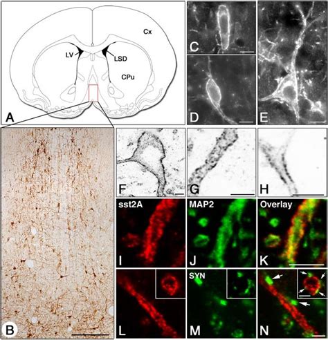 Regional and cellular localization of the sst 2A receptor in the rat ...