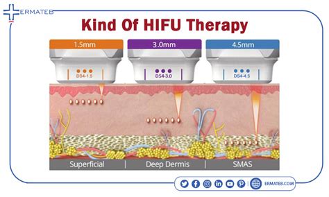 HIFU therapy benefits and its side effects