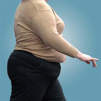 Obesity Prevention - WelcomeCure