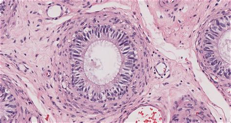 Testis and Epididymis – Normal Histology – NUS Pathweb :: NUS Pathweb