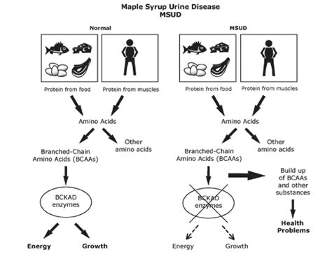 Maple Syrup Urine Disease Symptoms