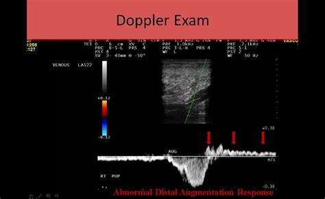 Vascular Ultrasound Registry Review Course