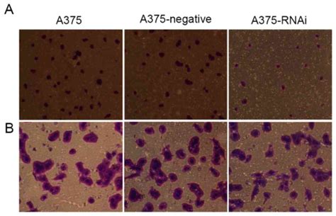 The biological effect and mechanism of the Wnt/β‑catenin signaling ...