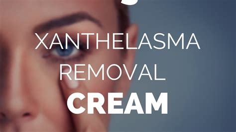 Xanthelasma removal cream, Xanthel, xanthelasma remover. - YouTube