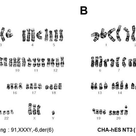 (PDF) Characterization of Tetraploid Somatic Cell Nuclear Transfer-Derived Human Embryonic Stem ...