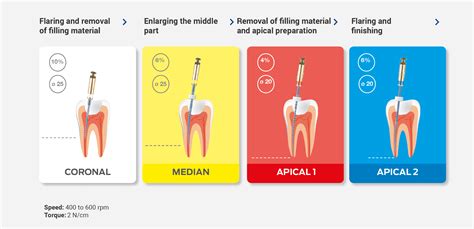 Protocol for retreatment - CMA