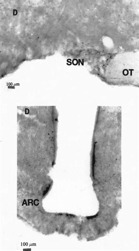 Light micrographs showing the supraoptic nucleus (SON; top) and the... | Download Scientific Diagram