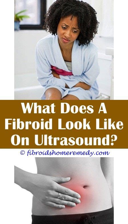 10 Cm Fibroid