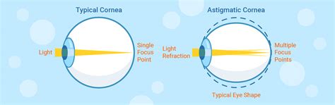 Astigmatism - Been A Better Portal Bildergallerie