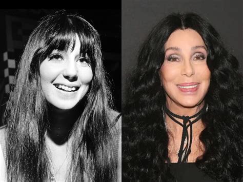 Cher's Plastic Surgery Journey: Before and After Analysis ...