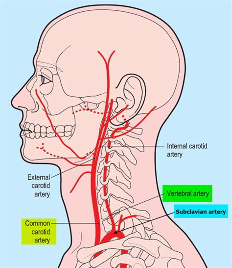 Vertebral Artery Segments, Stenosis and Artery Dissection Symptoms