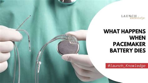 What Happens When Pacemaker Battery Dies - Launch Knowledge