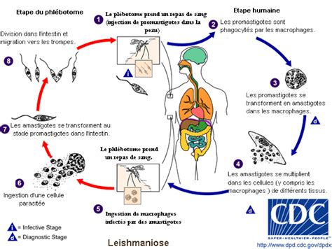 Leishmaniose cutanée - Leishmaniose cutanéo-muqueuse