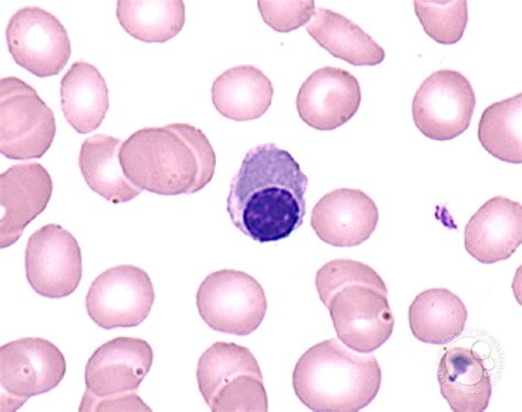 Nucleated Red Blood Cells - Rectangle Circle