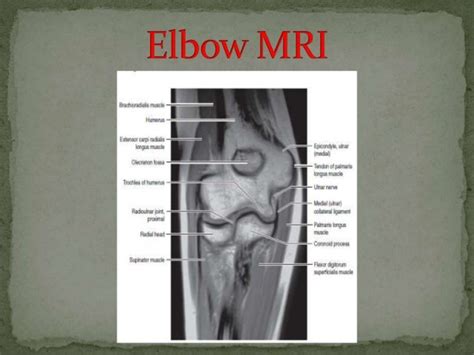 Elbow Anatomy Mri - Anatomical Charts & Posters