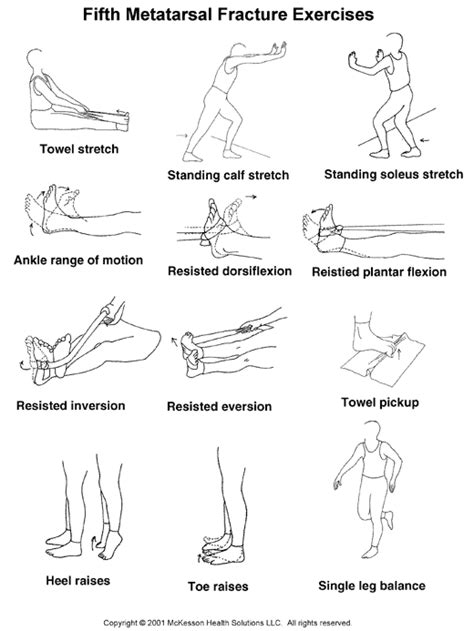 Sports Medicine Advisor 2003.1: Fifth Metatarsal Fracture Exercises ...